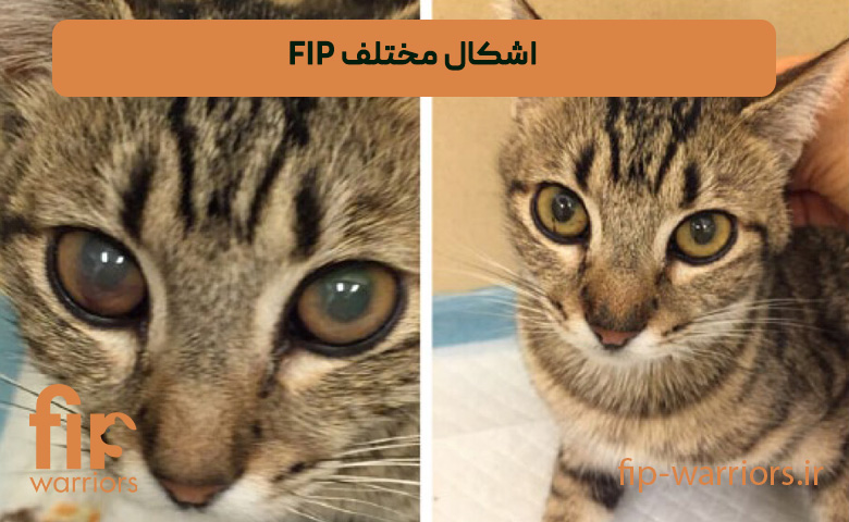 اشکال-مختلف-FIP