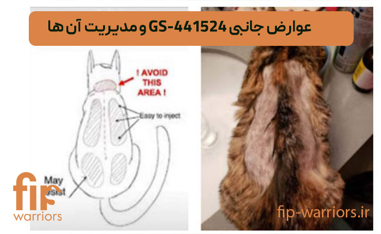 عوارض-جانبی-425144-SG-و-مدیریت--آن-ها
